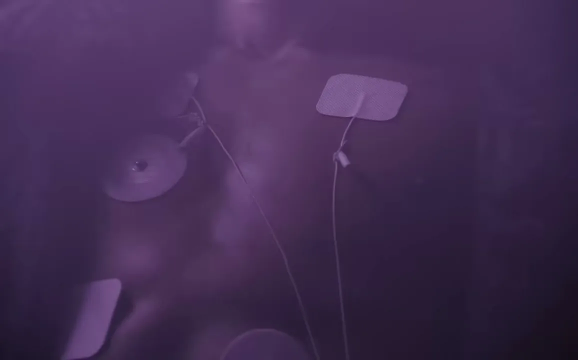 Starburst en vídeo (4)